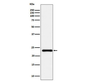 Anti-UBE2T / HSPC150, clone 31U48