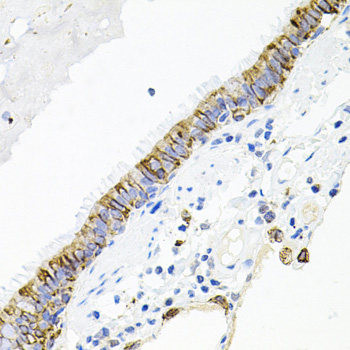 Anti-ACVR2A