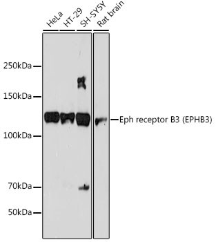 Anti-Eph receptor B3 (EPHB3)