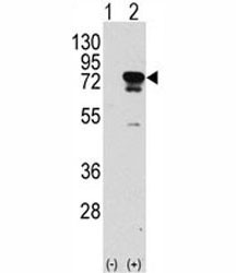 Anti-EIF4B