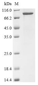 Neural cell adhesion molecule 1 (Ncam1), partial, mouse, recombinant