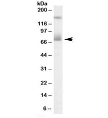 Anti-Mesothelin