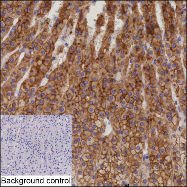 Anti-ABCB1