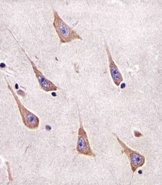 Anti-RAB11A, clone 1565CT164.36.80