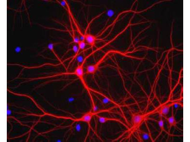 Anti-Microtubule Associated Protein 2 (MAP2)