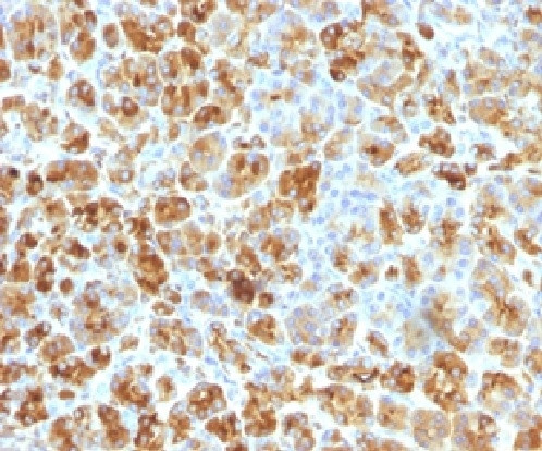 Anti-Alpha-1-Antichymotrypsin (SERPINA3) (Histiocytoma Marker), clone AACT/1451