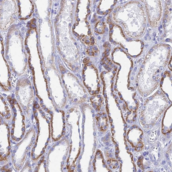 Anti-ACSM1