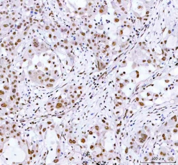 Anti-ARID domain-containing protein 1A / ARID1A