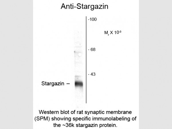 Anti-Stargazin