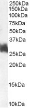 Anti-FRA1, Internal