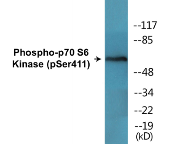 p70 S6 Kinase (Phospho-Ser411) Colorimetric Cell-Based ELISA Kit