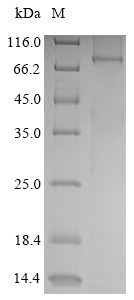 Receptor-interacting serine/threonine-protein kinase 1 (Ripk1), mouse, recombinant