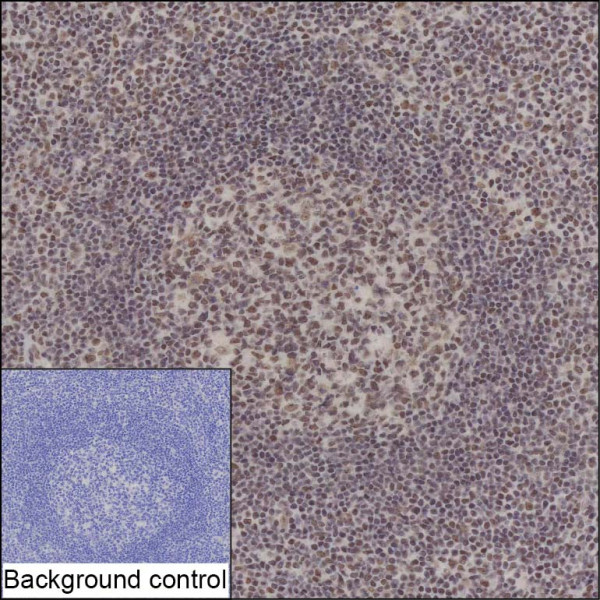Anti-RBM15