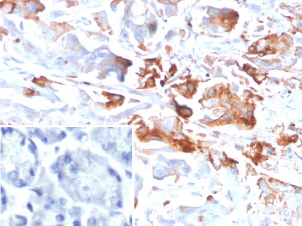 Anti-CEACAM1 (CEA Cell Adhesion Molecule 1), clone CEACAM1/4840