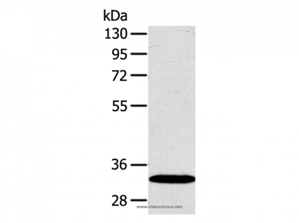 Anti-SULT2A1