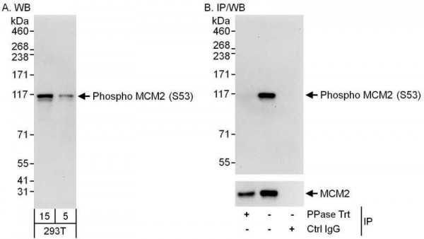 Anti-phospho-MCM2 (Ser53)