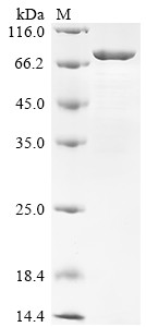 ATP-dependent RNA helicase DDX19B (DDX19B), human, recombinant