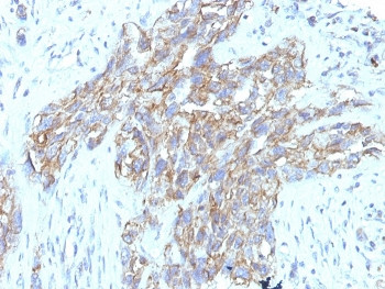 Anti-NCAM / CD56 Cocktail, clone 123C3.D5 + 123A8