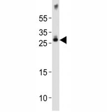 Anti-Olig1