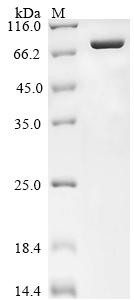 DNA topoisomerase 1 (TOP1), partial, human, recombinant