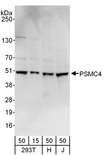 Anti-PSMC4