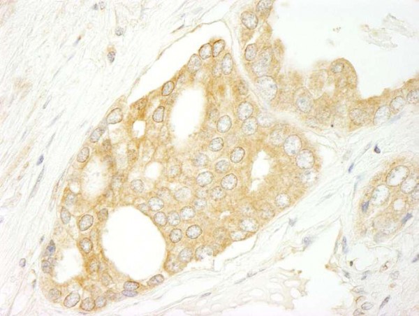 Anti-BRAF (IHC)