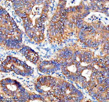 Anti-CTSF / Cathepsin F