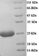 Complement C1q subcomponent subunit A (C1qa), mouse, recombinant
