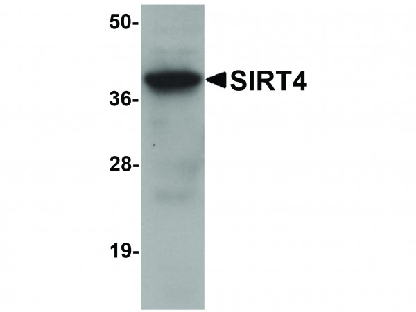 Anti-SIRT4