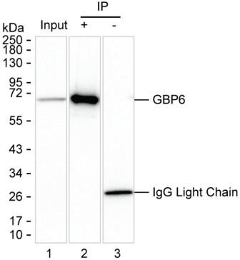 Anti-GBP6
