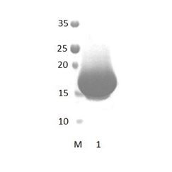 HTRA1 PDZ Domain