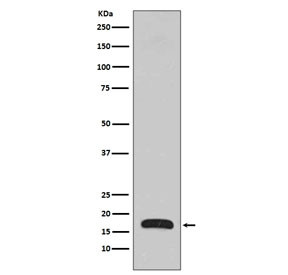 Anti-ARPC5 / p16 ARC, clone CCD-1
