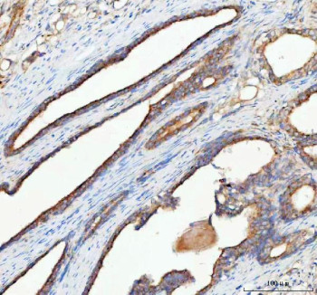 Anti-RHOT2 / Rho GTPase 2 / MIRO2