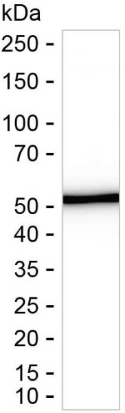 Anti-HMGCS1