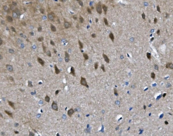 Anti-Chat / Choline Acetyltransferase