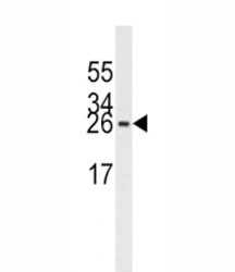 Anti-EIF4E, clone 163CT48.1.9