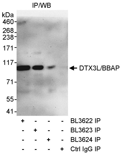 Anti-DTX3L/BBAP