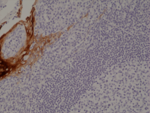 Anti-Cytokeratin-4 (human), Rabbit Monoclonal (RM355)