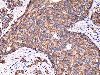 Anti-HER2 (human), Rabbit Monoclonal (RM228)