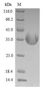 Latent membrane protein 1 (LMP1), partial, Epstein-Barr virus, recombinant
