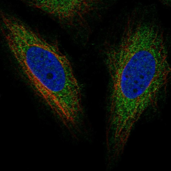 Anti-TOR1AIP2