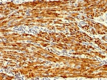 Anti-Calponin, clone SPM169