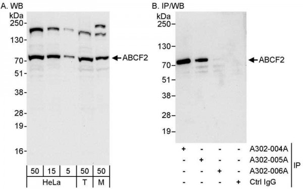 Anti-ABCF2