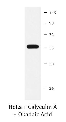 Anti-phospho-c-Myc (Thr58)