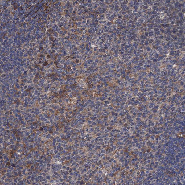 Anti-ARHGAP11A