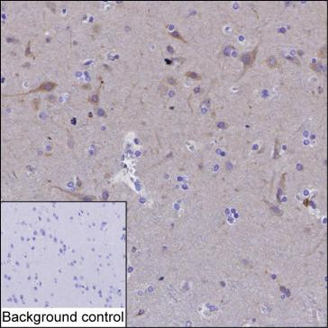 Anti-HMGCR