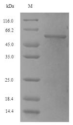 Phosphoribosylamine--glycine ligase (purD), Escherichia coli O157:H7, recombinant