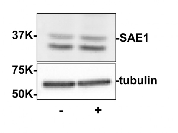 Anti-SUMO Activating Enzyme E1 (SAE1)