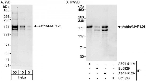 Anti-Astrin/MAP126