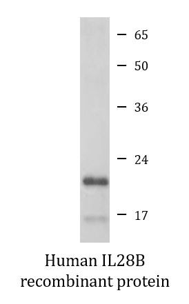 Human IL28B recombinant protein (Active)